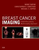 Breast Cancer Imaging - A Multidisciplinary Multimodality Approach