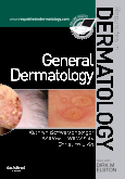 General Dermatology - Requisites in Dermatology