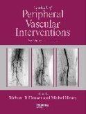 Textbook of Peripheral Vascular Interventions-2판
