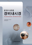 경비내시경(Transnasal Endoscopy)