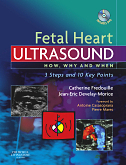 Fetal Heart Ultrasound-1판