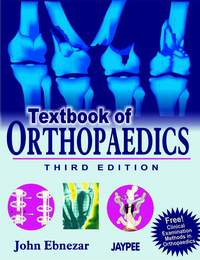 TEXTBOOK OF ORTHOPAEDICS