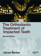 The Orthodontic Treatment of Impacted Teeth