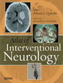 Atlas of Interventional Neurology