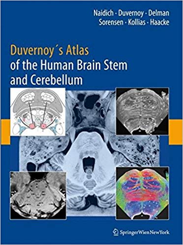 Duvernoy`s Atlas of the Human Brain Stem and Cerebellum