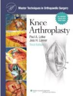 (MTO)Master Techniques in Orthopaedic Surgery: Knee Arthroplasty 3e