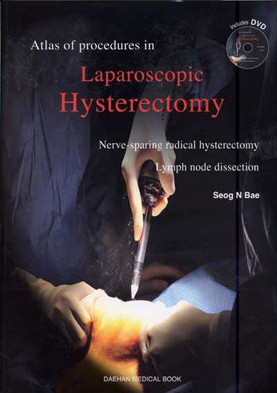 Atlas of Procedures in Laparoscopic Hysterectomy(DVD포함)