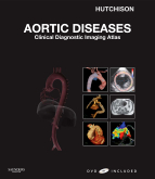 Aortic Diseases - Clinical Diagnostic Imaging Atlas with DVD