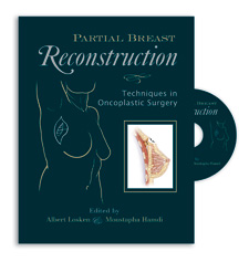 Partial Breast Reconstuction : Techniques in Oncoplastic Surgery 1DVD