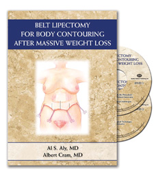 Belt Lipectomy for Body Contouring after Massive Weight Loss 2 2DVD