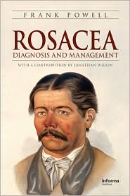 Rosacea : Diagnosis and Management