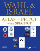 Atlas of PET/CT with SPECT / CT with DVD