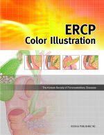 ERCP Color Illustration