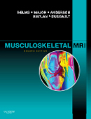 Musculoskeletal MRI 2/e