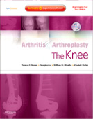 Arthritis and Arthroplasty:The Knee: Expert Consult - Online Print and DVD
