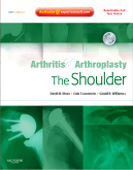 Arthritis and Arthroplasty:The Shoulder: Expert Consult - Online Print and DVD