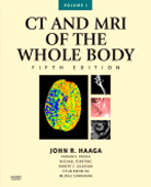 CT and MRI of the Whole Body-5판 2Vols