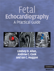 Fetal Echocardiography A Practical Guide