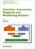 Detection Assessment Diagnosis and Monitoring of Caries