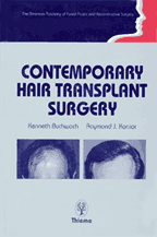 Contemporary Hair Transplant Surgery : American Academy of Facial and Plastic Reconstructive Surgery