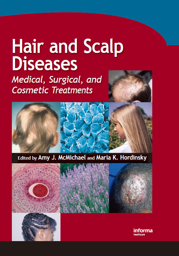 Hair and Scalp Diseases : Medical Surgical and Cosmetic Treatments