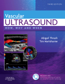 Vascular Ultrasound : How Why and When-3판