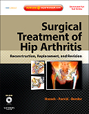 Surgical Treatment of Hip Arthritis: Reconstruction Replacement and Revision