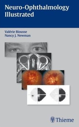 Neuro Ophthalmology Illustrated