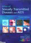 Atlas of Sexually Transmitted Disease/ AIDS 3/e