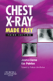 Chest X-Ray Made Easy 3/e