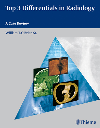 Top 3 Differentials in Radiology : A Case Review