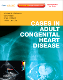 Cases in Adult Congenital Heart Disease Expert Consult: Online and Print - Atlas with DVD- ROM