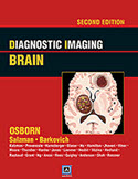 Diagnostic Imaging:Brain-2판