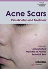 Acne Scars: Classification and Treatment-1판(2009)