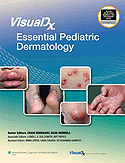 VisualDx: Essential Pediatric Dermatology