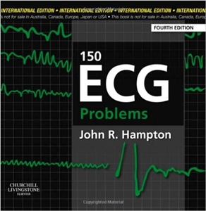 150 ECG Problems-4판