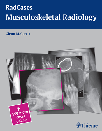 RadCases: Musculoskeletal Radiology