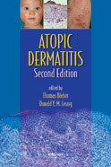 Atopic Dermatitis-2판