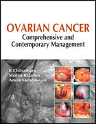 Ovarian Cancer : Comprehensive and Contemporary Management