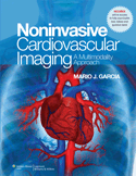 NonInvasive Cardiovascular Imaging : A Multimodality Approach Hardbound