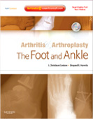 Arthritis and Arthroplasty: The Foot and Ankle - Expert Consult - Online Print and DVD