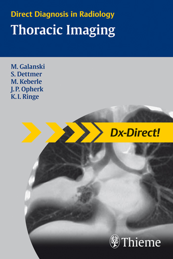 Thoracic Imaging (Direct Diagnosis in Radiology)
