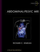 Abdominal-Pelvic MRI 3/e(2Vols)