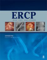 ERCP(Endoscopic Retrograde Chalangio Pancreatography)