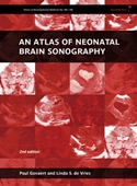 An Atlas of Neonatal Brain Sonography