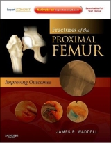 Fractures of the Proximal Femur: Improving Outcomes