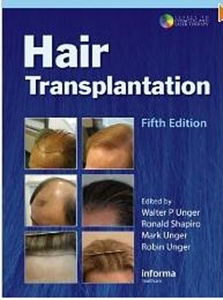 Hair Transplantation-5판 (DVD포함)