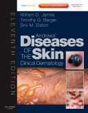 Andrews' Diseases of the Skin 11/e