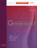 Gynaecology(Gynecology)-4판-xpert Consult: Online and Print