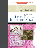 Scheuer's Liver Biopsy Interpretation-8판